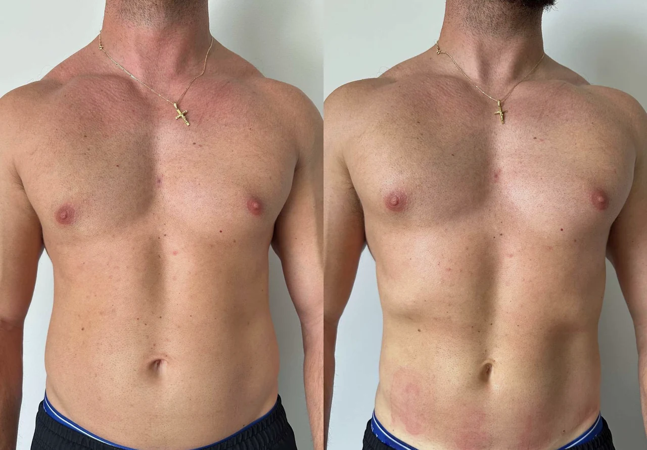 Before and after 4 — The Blueprint client &mdash; BodyWorks Alpharetta